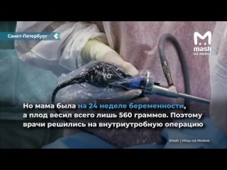 doctors of the st. petersburg pediatric university for the first time in russia operated on a teen right in the womb